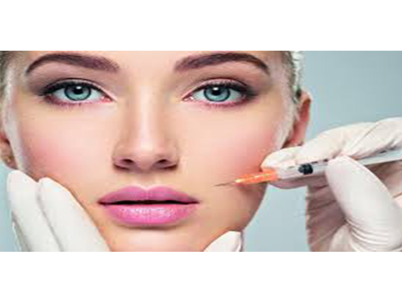 حقن هلام الشفة